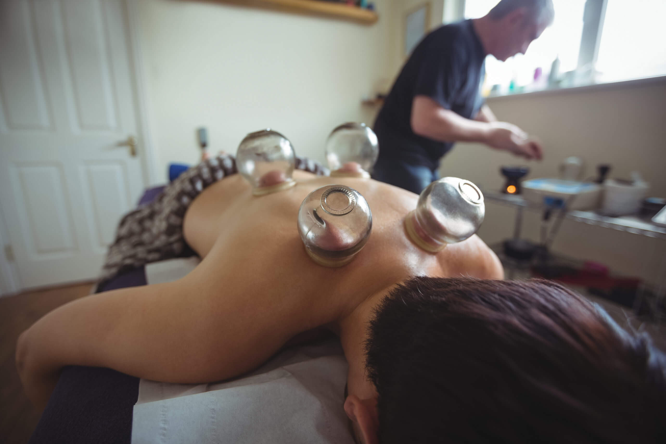 physical therapist performing cupping treatment